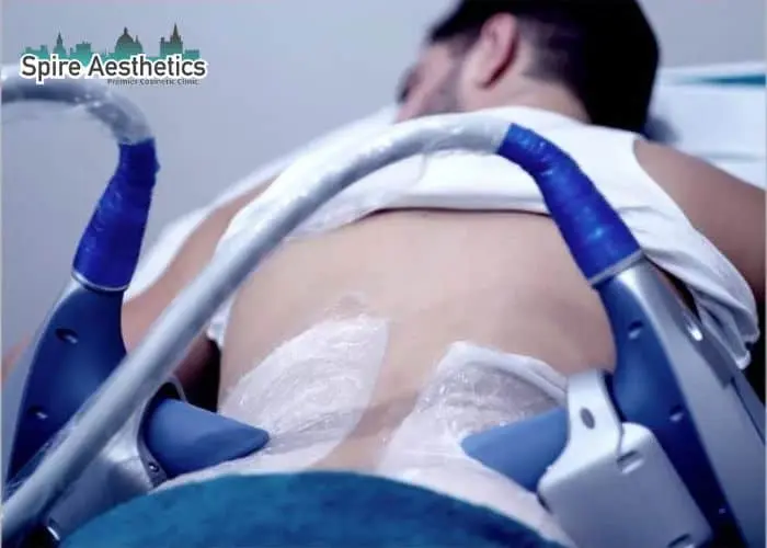 Man having fat freezing treatment done on love handles before a competitions Warfield to create a sculpted look.