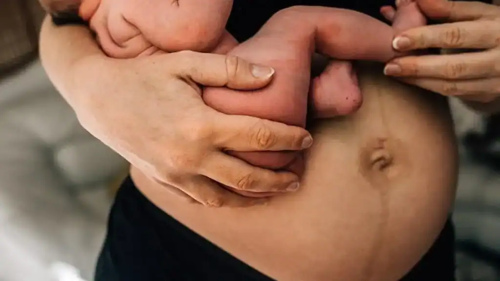 Why Is My Stomach Still Big After Pregnancy Warfield?